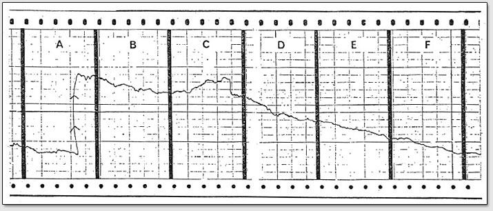 Рис. 5.  Данная диаграмма, записанная самописцем растения,  показывает в блоке 