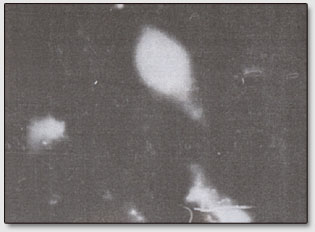 Фото 4. Электрическое состояние кожи того же участка пальца т. Криворотова, что и на фото 3 (увеличено в 500 раз). Авторы - супруги Кирлиан.