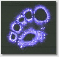 Кирлиан-снимок пальцев ног, сделанный при помощи кирлиан-прибора фирмы "Biomed"