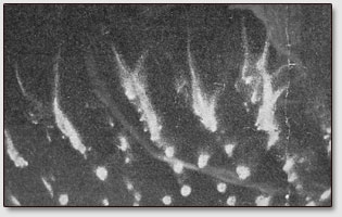 Увеличенный в 50 раз кирлиан-снимок подушечки пальца руки А.Е.Криворотова, готового к процессу излечения. Автор С.Д.Кирлиан.