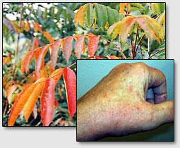 Плацебо-эффект в кожных раздражениях под влиянием лакового дерева Urushi. Исследование японских врачей Юджиро Икеми и Шунджи Накагава