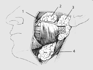 Слюнные железы ротовой полости. 1 - околоушный проток; 2 - околоушная железа; 3-добавочная околоушная железа; 4 - поднижнечелюстная железа.